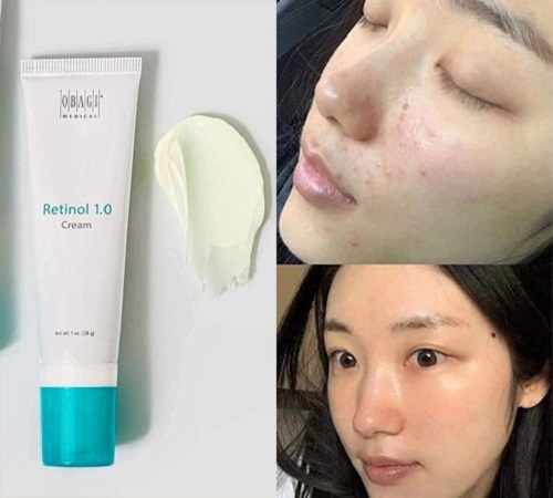 retinol 1.0